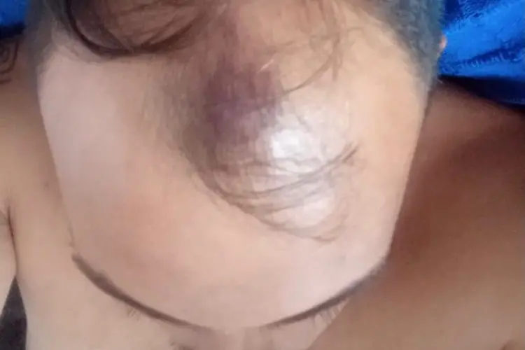 Trabajador agredido.